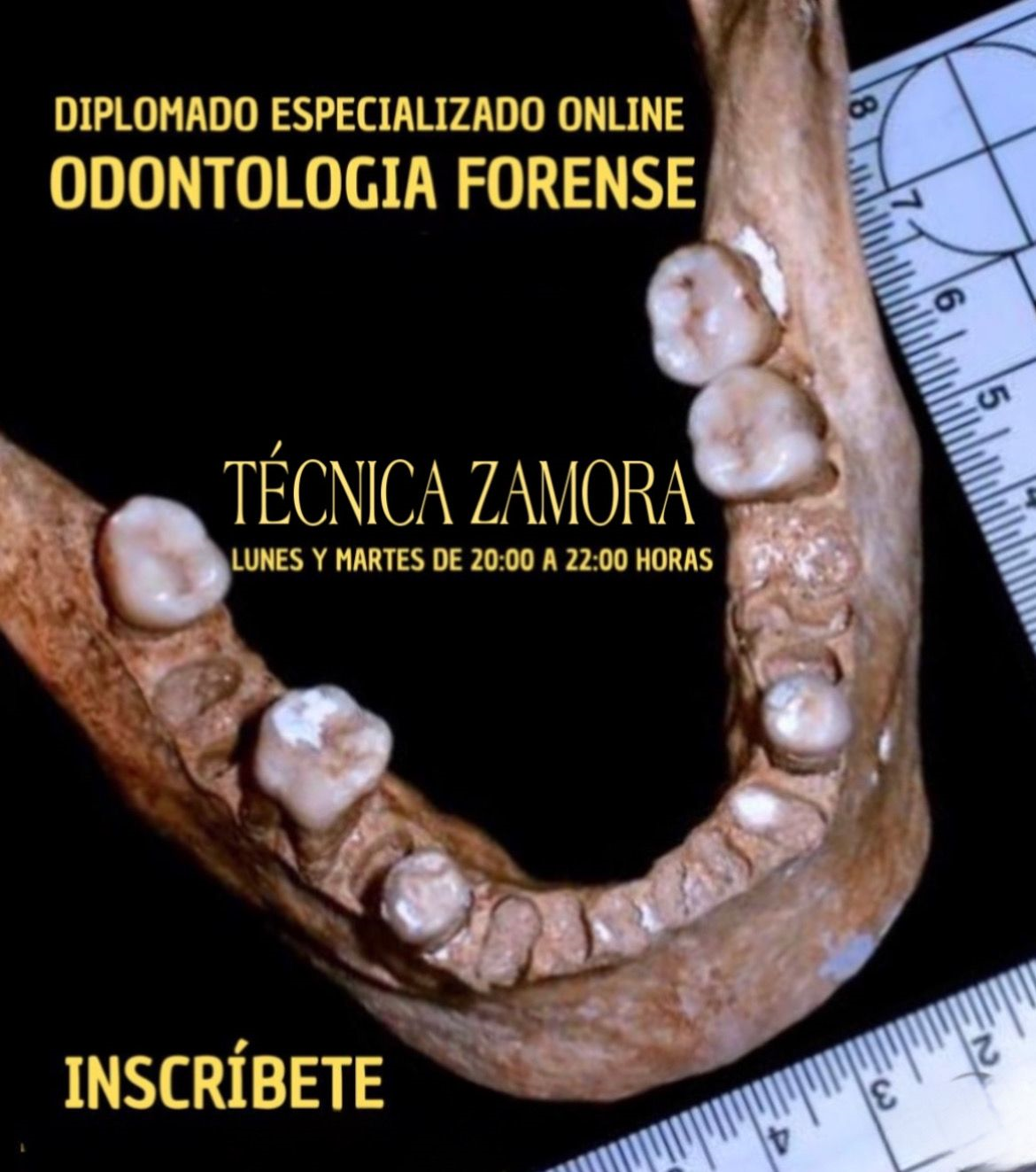 Diplomado Especializado Online Odontología Forense 